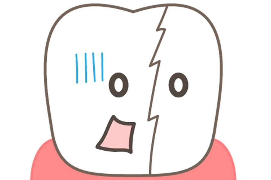 歯のくいしばりが気になる方は、JR摂津本山駅近くの岡本歯科ロコクリニック