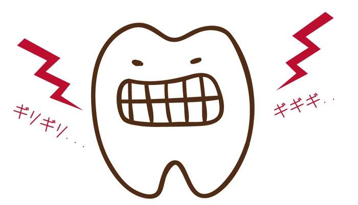 歯ぎしり食いしばりの影響って？JR摂津本山駅の岡本歯科ロコクリニック