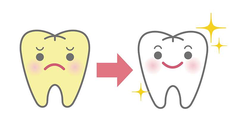 歯の黄ばみを歯科医院で落とす！JR摂津本山駅の岡本歯科ロコクリニック