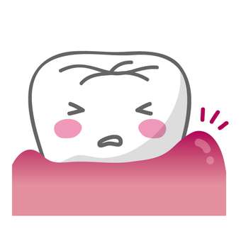 智歯肉炎の症状とは？JR摂津本山駅の岡本歯科ロコクリニック